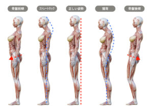 不良姿勢の図説